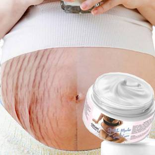 GULGLOW99 Remove Pregnancy Scars Cream