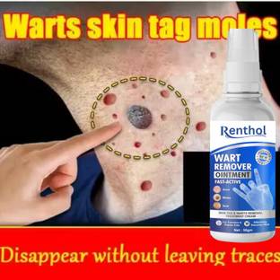 Renthol Wart Remover, Wart Remover Cream For Wart Removal| Massa Remover For Skin | Skin Tag Remover Cream | Remove Warts and Tags Painlessly-w7