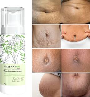 Eczemaron Ringworm Hydrates and Brightens