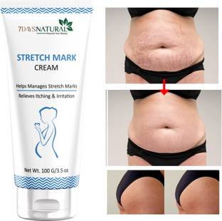 7days natural Stretch Marks Removal Cream for Remove dark spot circles, Acne Blemishes Intimate Cream