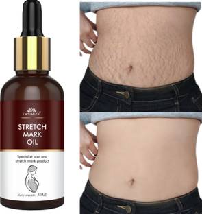 INTIMIFY Stretch Marks Removal Oil For Women, During After Pregnancy