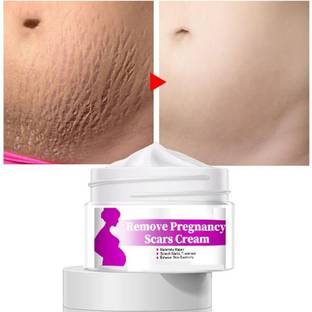 GULGLOW99 Perfect For All Pregnant Lady Use Scar Removal Cream
