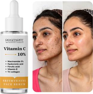 RoseBrite Vitamin C + Collagen Serum – With Niacinamide, HA & Ferulic Acid to Brighten, Hydrate & Restore Youthful Glow