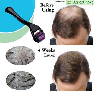 Ramya beauty care JABRA Derma Roller 0.5mm 540 Titanium Micro Needles for Hair&Beard Growth
