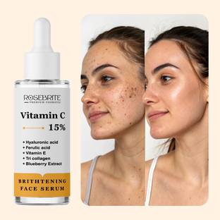 RoseBrite Anti-Dark Spot Face Serum – Vitamin C-Based Glow & Clarity Booster