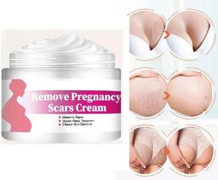 WOONGMI New Korean Stretch Mark is Suitable for Pregancy Stretch Marks,Belly Fat Stretch,Breast