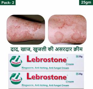Lebrostone Ayurvedic Skin Care Treatment Cream 25g – For Ringworm, Itching & Fungal Infections (Pack of 2)