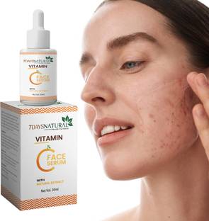 7days natural Vitamin C + E Face Serum For Brightening Skin | Niacinamide Acid | Fades Dark Spots | Acne Pimple | pigmentation Scar Marks Removals