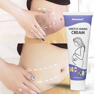 Sonavi Pregnancy and Maternity Stretch marks Removal Cream for Women