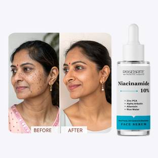 RoseBrite Niacinamide Face Serum with Zinc PCA – Clears Acne, Refines Pores, Balances Oil, Fights Redness and Improves Texture
