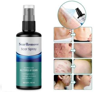 PHIZLLER Scar Remove Spray for All Types of Scars Scar Spray Acne Treatment