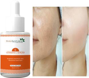 7 Days Vitamin C Serum with niacinamide for dark spot Acne |pigmentation anti blemish