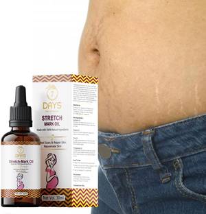 7 Days stretch marks oil after delivery stretch mark removal cream oil during pregnancy