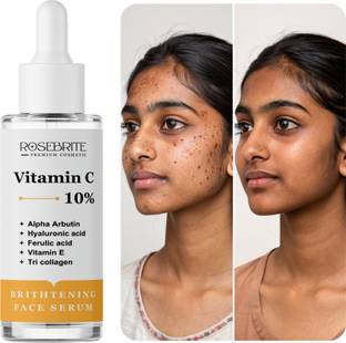 RoseBrite Vitamin C + Squalane Serum – Nourishes Dry Skin While Correcting Dark Spots & Improving Skin Clarity