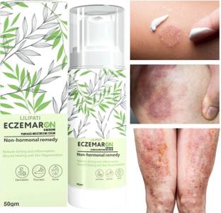 LILIPATI skin fungal infection cream Pack-1