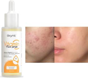 Skynic 10% Vitamin C + E Face Serum With Alpha Arbutin | Glowing Skin & Spot Reduction | For All Skin Types