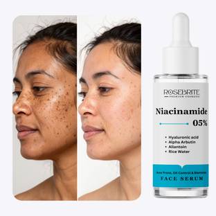 RoseBrite Glow-Boosting Face Serum with 5% Niacinamide, Alpha Arbutin and Hyaluronic Acid for Smooth, Youthful-Looking Skin