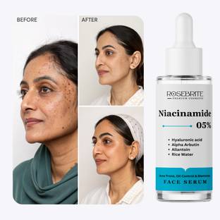 RoseBrite Face Serum for Redness & Pores – Calms Irritation, Shrinks Pores & Balances Sebum Without Clogging or Drying