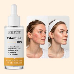 RoseBrite Best Vitamin C Serum for Pigmentation & Dull Skin – Brightens, Reduces Melasma & Boosts Collagen for Youthful, Radiant Skin