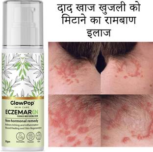 GlowPop Herbal Eczemaron Anti Fungal Cream Men & Women