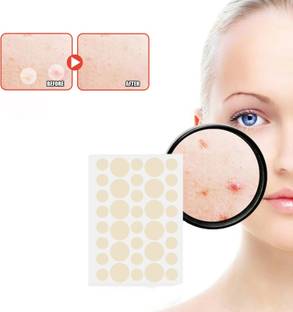 tanvi27 Acne Pimple Master Patch