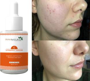 7days natural Vitamin C Face Serum for Skin Radiance | dark spot | pigmentation anti blemish