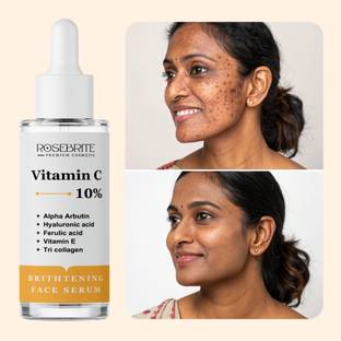 RoseBrite Vitamin C 10% & Alpha Arbutin Facial Serum – Reduces Hyperpigmentation, Brightens Dull Skin & Improves Elasticity