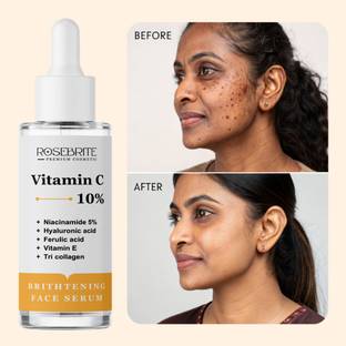 RoseBrite Pore-Minimizing Vitamin C Serum – Smooths Skin Texture, Enhances Brightness & Reveals a Luminous, Radiant Complexion