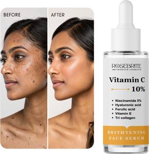 RoseBrite Vitamin C Face Serum – For Hyperpigmentation, Dullness & Uneven Tone – Lightweight Formula With Visible Results