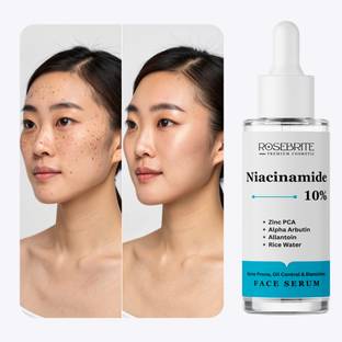 RoseBrite Acne-Fighting Niacinamide 10% Serum - Zinc PCA & Alpha Arbutin Formula Prevents Breakouts While Fading Post-Acne Dark Spots