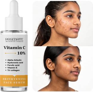 RoseBrite Vitamin C Serum for Dry Skin – Ultra-Hydrating Formula Lightens Dark Spots & Restores Soft, Supple Texture