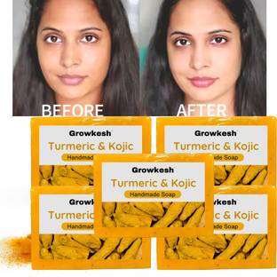 Growkesh Bathing Soap for Radiant Skin | Soap | Soap For Men & Women