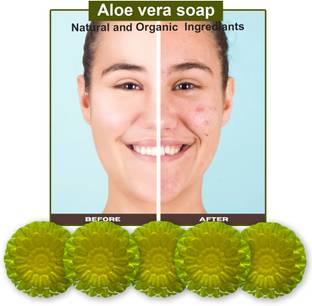 CHITAKSH Aloe Vera Rich Bathing Soap (100GM) (PACK OF 5)