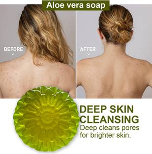 CHITAKSH Gentle Aloe Vera Soap with Chamomile for Baby's Skin