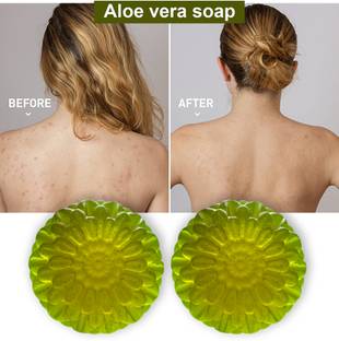 TERIHAR Aloe Vera Soap for Psoriasis-prone Skin (100GM) (PACK OF 2)