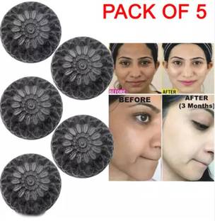 Kalah Herbals ACTIVATED CHARCOAL Natural Hand Made Soap Pack of 5