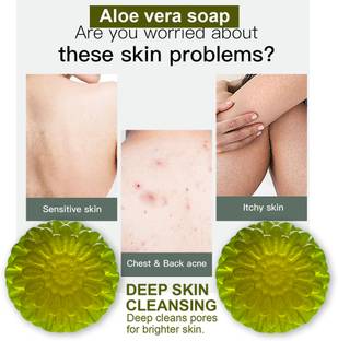 CHITAKSH Refreshing Aloe Vera Soap (100GM) (PACK OF 2)