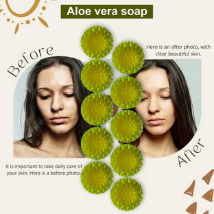 CHITAKSH Aloe Vera and Green Tea Soap Bar (100GM) (PACK OF 10)
