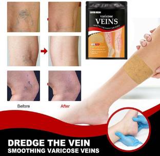 FLOSTRAIN Veins Patches Dredge Vein Smoothing Varicose Veins Heel Support