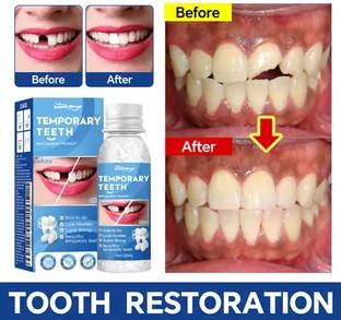 SHETZOI Tooth Repair Kit Teeth Replacement Kit for Temporary Restoration of Missing_03 Teeth Whitening Kit