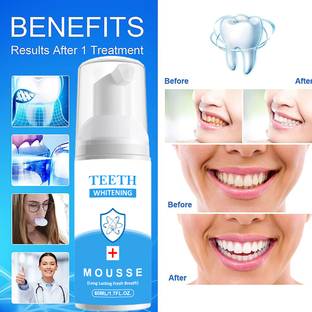 Latibule Teeth Whitening Foam Kit to Ultra-fine Deeply Clean Gums Intensive Stain Removal Teeth Whitening Kit