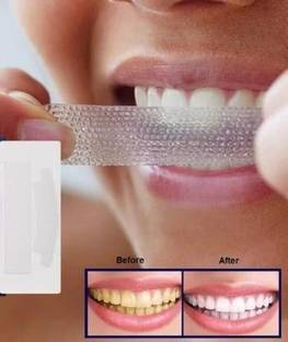 OSUFI Portable Advanced Professional Teeth Whitening Strips Teeth Whitening Kit