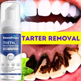 smartdrops Whitening Foam to Ultra-fine Deeply Clean Gums Stain Removal Teeth Whitening Kit