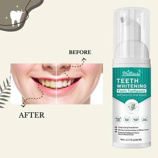 Phillauri Dazzle Bright Teeth Whitening Foam, Your Path to a Radiant Smile Teeth Whitening Kit
