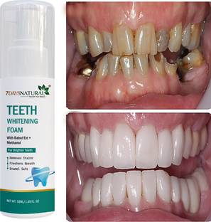 7DAYS Teeth Whitening Foam to Ultra-fine YELLOW TEETH Deeply Intensive Stain Removal Teeth Whitening liquid