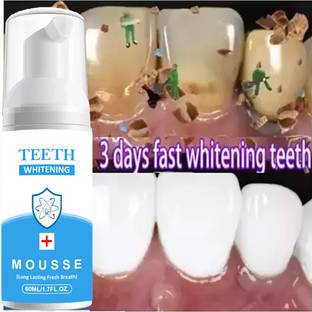 REGLET Teeth Whitening foam Make your Teeth Sparkle And White Teeth Whitening kit Teeth Whitening liquid