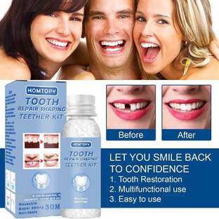 ERVY Tooth Repair Kit, Temporary Teeth Gap Repair Kit [30 ml] Teeth Whitening Kit
