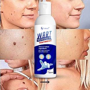 femoz Wart remover ointment cream for fast wart removal Men & Women girls Men & Women