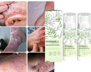 Latibule Anti-Fungal Cream for Powerful Treatment and Prevention of Fungal Skin & Nail Men & Women