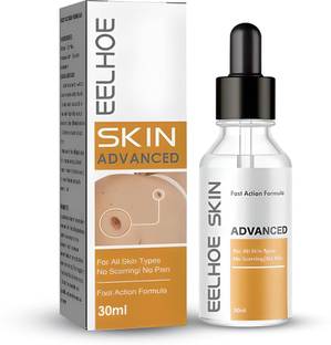 Kudh Products Skin Tag Remover Serum – Fast-Acting & Painless Mole & Wart Removal Men & Women
